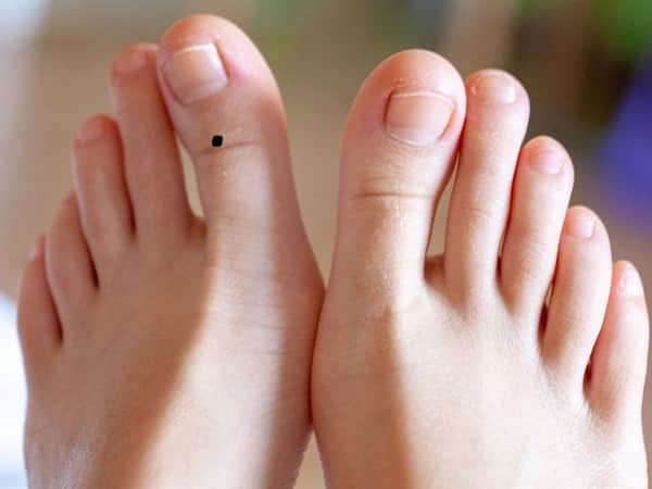Xem bói nốt ruồi ở ngón chân