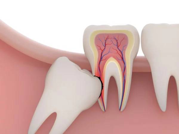Giấc mơ thấy nhổ răng có khiến bạn thấy lo lắng?