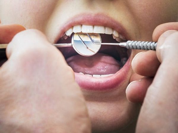 Giấc mơ thấy nhổ răng có khiến bạn thấy lo lắng?